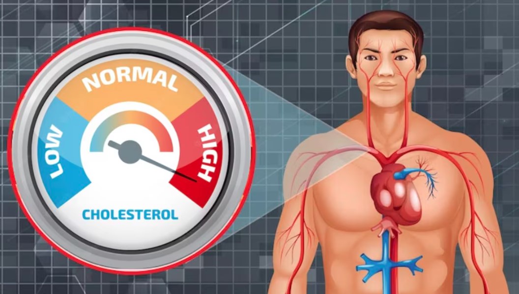 शरीर में क्यों बढ़ता है कोलेस्ट्रॉल का लेवल? आइये जानते हैं क्या कहते हैं स्वास्थ्य विशेषज्ञ
