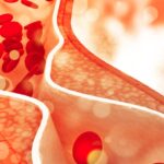 हाथ-पैर और आंखों के ये बदलाव बता सकते हैं बढ़ता कोलेस्ट्रॉल