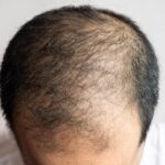 क्या सच में हेलमेट पहनने से झड़ते हैं बाल? जानिए हकीकत