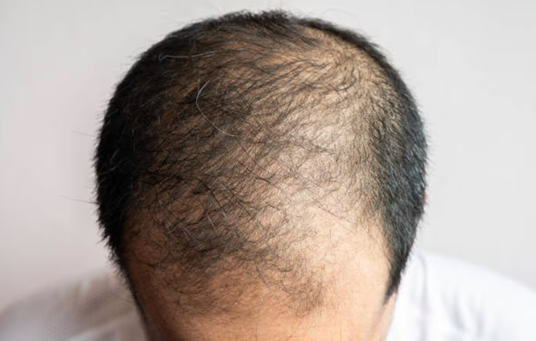 क्या सच में हेलमेट पहनने से झड़ते हैं बाल? जानिए हकीकत