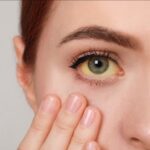 क्या है पीलिया, और यह कैसे विकसित होता है? आइये जानते हैं इसके लक्षण और कारण